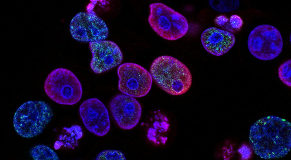 Cancer cells Call illustration